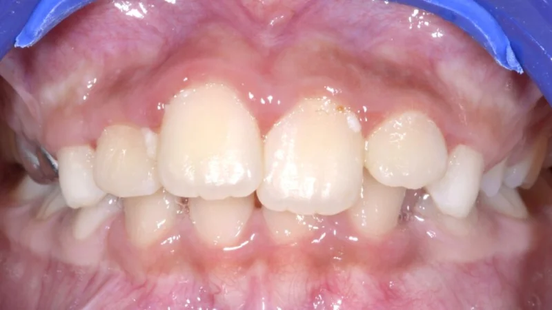Mint Dental Care LLC photo 7