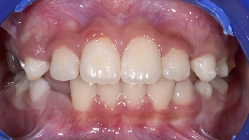 Mint Dental Care LLC photo 8