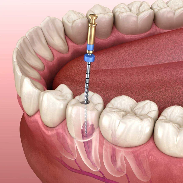 Lotus Dental Clinic L L C photo 2