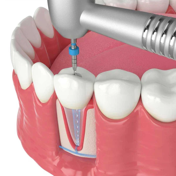 Lotus Dental Clinic L L C photo 5