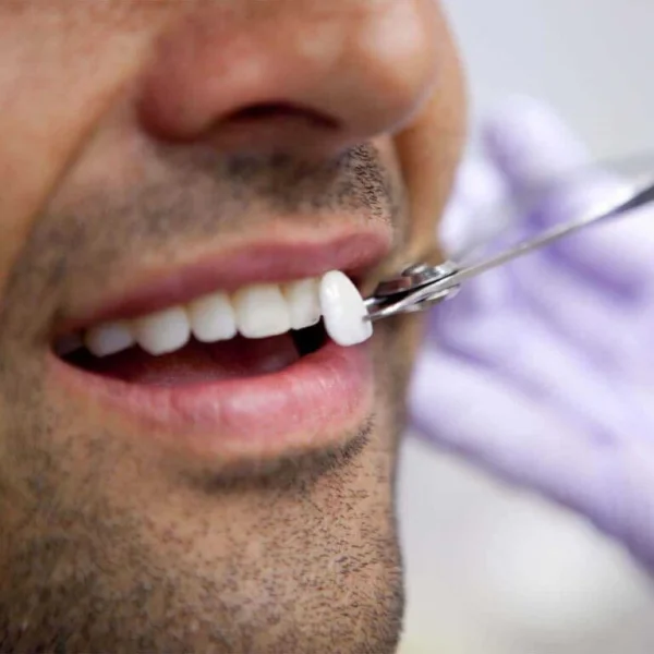 Babylon Dental Center L.L.C photo 7