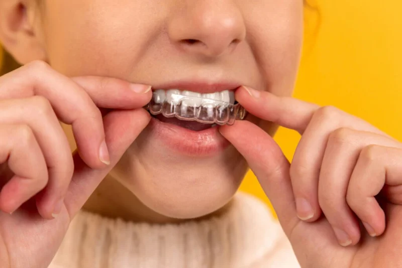 SMILE BY DR NOURA CLINIC  photo 6