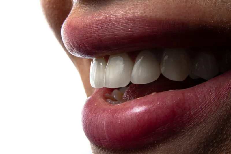 SMILE BY DR NOURA CLINIC  photo 8