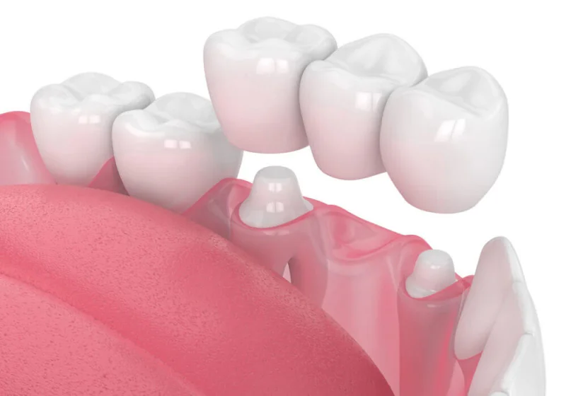 NOBLE CARE DENTAL CLINIC L.L.C photo 5
